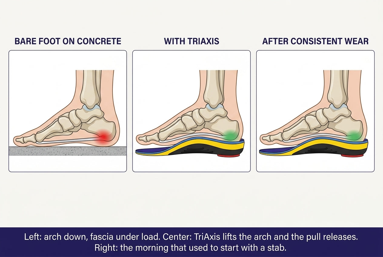 Three-panel cross-section: a bare foot with a collapsed arch and taut fascia on concrete; the same foot on the TriAxis insole with the arch lifted and the fascia slack; and the supported posture maintained after consistent wear.